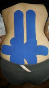 Tejpování,Tejpy,Kinesiotaping,regenerace pohybového aparátu